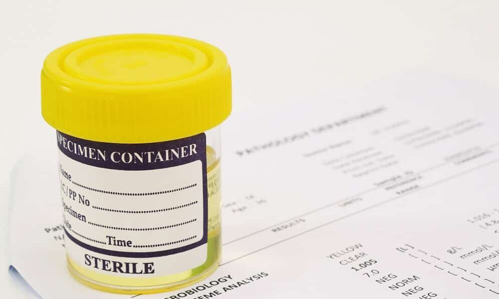 È necessario sottoporsi a un esame delle urine prima di prendere gli antibiotici